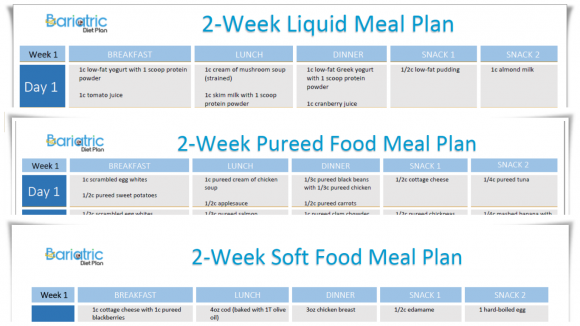 Post Op Gastric Sleeve Diet Plan Post Op Gastric Sleeve Diet Plan