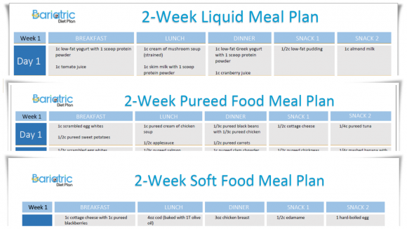 Post Op Gastric Sleeve Diet Plan